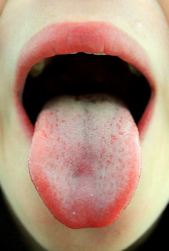 tongue01