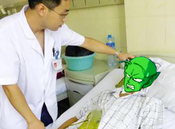Man accidentally morphs into Dragon Ball’s Piccolo, seeks professional help