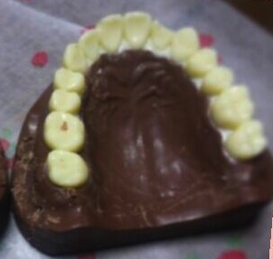 Chocolate teeth