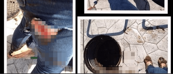 Woman falls down open manhole into excrement-filled drain, lives to tweet about it