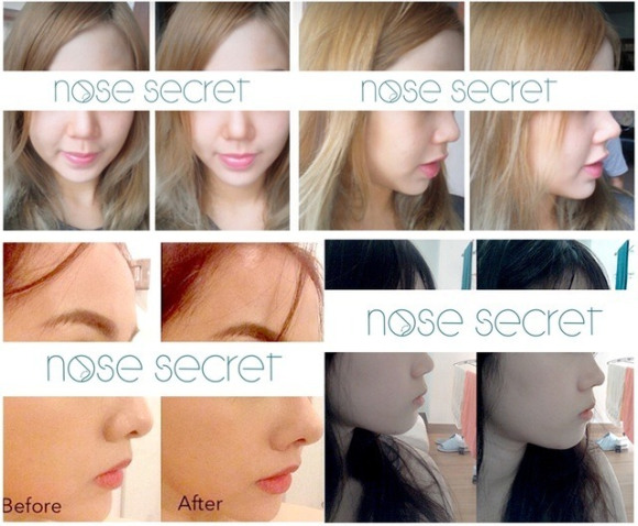 Can’t afford a nose job? Give your hooter some lift with Nose Secret!