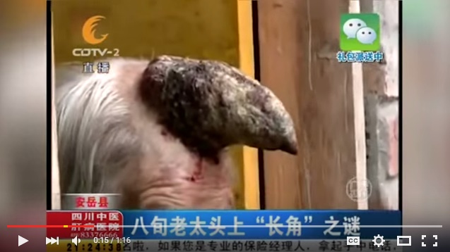 Large horn growing out of woman’s head in China