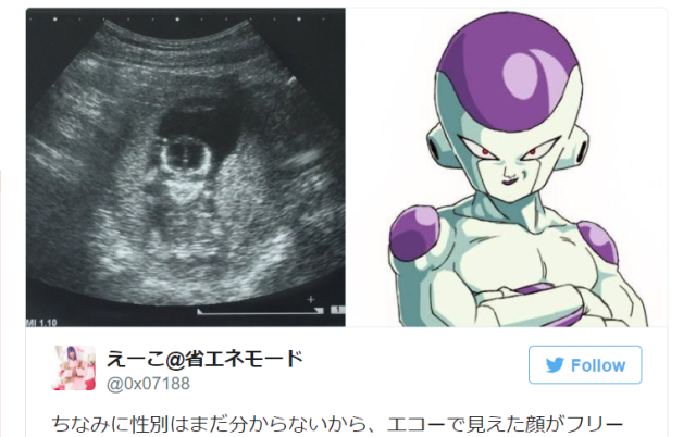 Pregnant Japanese woman’s ultrasound looks eerily like a character from anime Dragon Ball Z