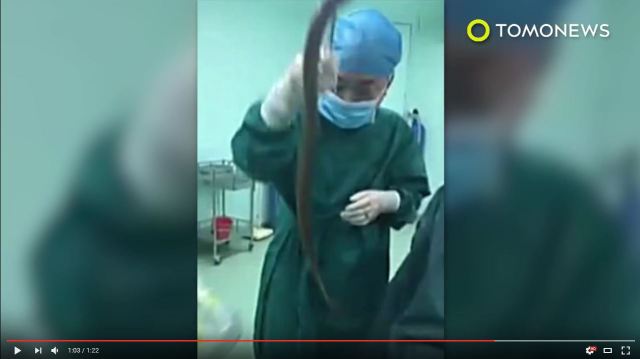 Man puts 50-centimeter live eel into anus to treat constipation, doesn’t go as planned