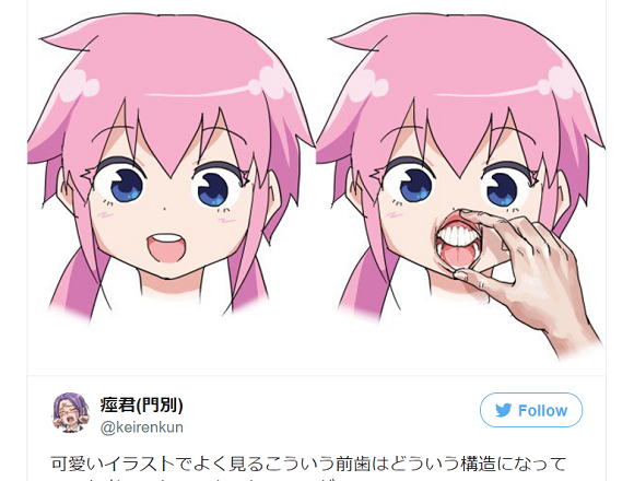 Anime isn’t like reality: Terrifying dentistry edition