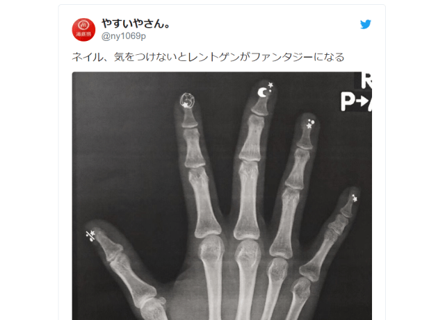 How to use nail art to turn your scientific X-ray into a fantasy wonderland
