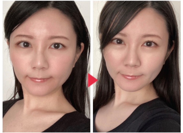 Medi Lift: the Japanese beauty product that promises facelift