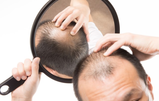 Japanese researchers learn how to grow hair follicles, and probably new hair
